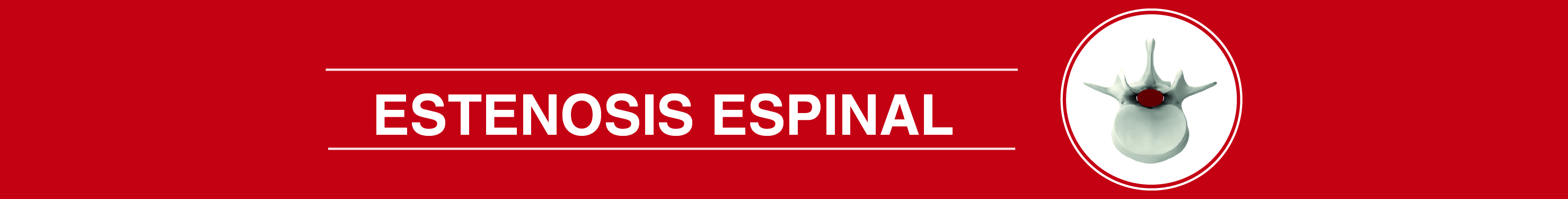 ESTENOSIS 06