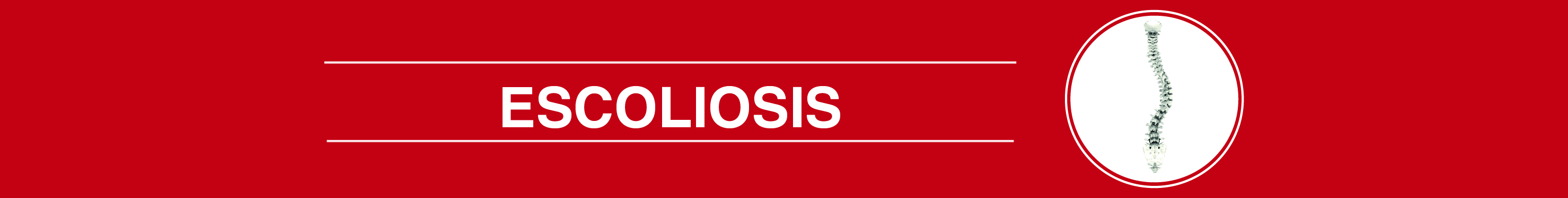 escoliosis 05