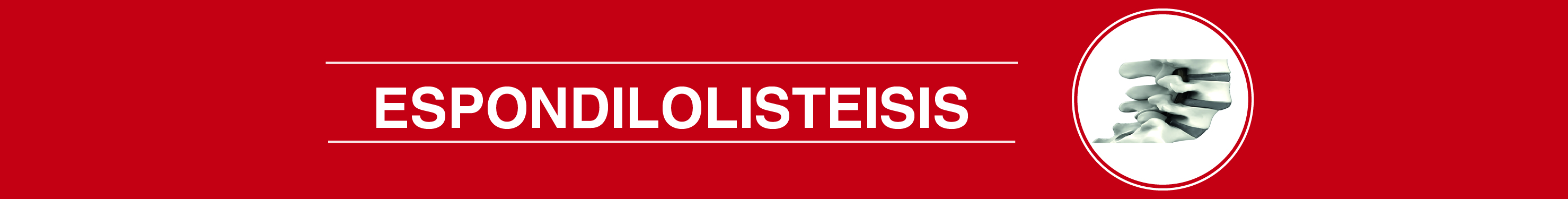 espondilolisteisis
