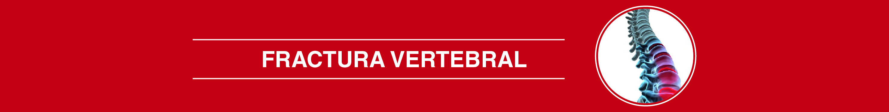 fracturavertebral