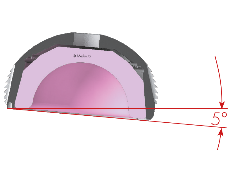 cc trio use an effective locking mechanism