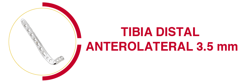 irene tibia anterolateral