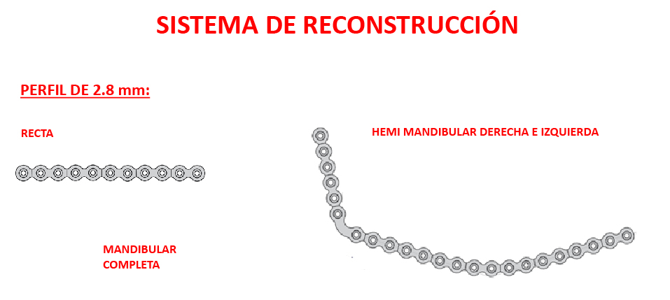 maxilo RECONSTRUCCIÓN 2.8