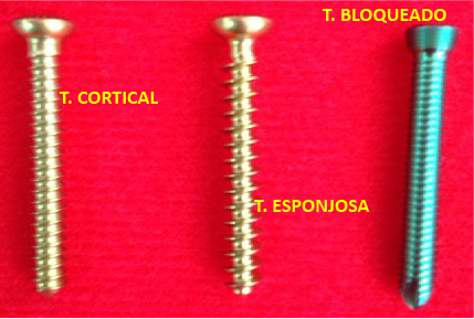 trauma SET DE TORNILLOS PARA SISTEMA DE 3.5 mm