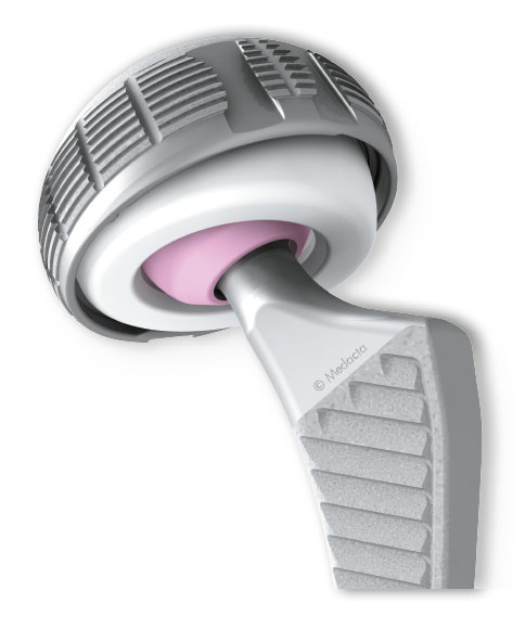 versafitcup dm cut